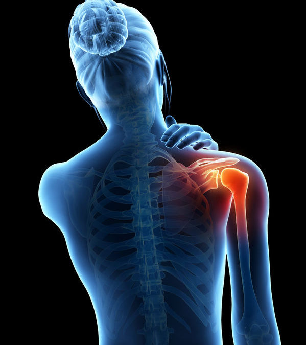 My Shoulder Hurts Too Much to be "Frozen"