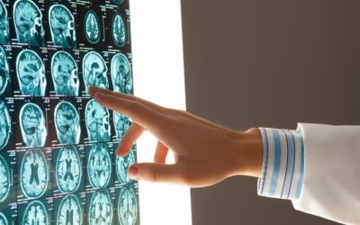 Lifelong Recovery from Neurological Injury